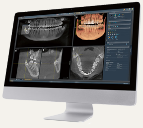 computerized dental implant and crown procedures