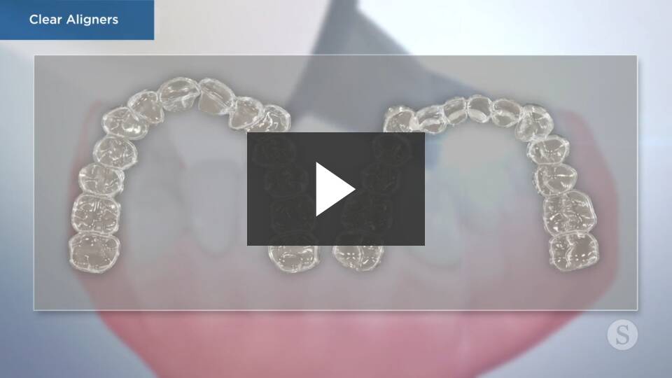 Invisalign video thumbnail